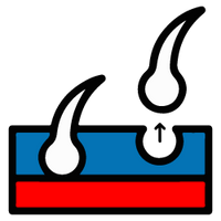 Hair line reversal program