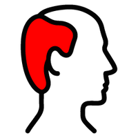 Dupa reversal program