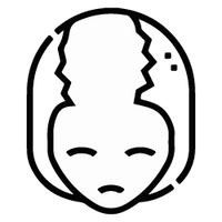 Alopecia areata incognito reversal program