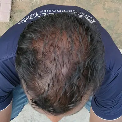 After - Deepak Arora