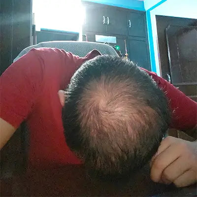 Before - Deepak Arora