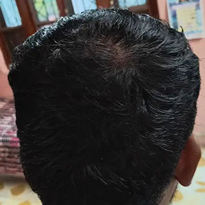 After - Sachin Nagpal