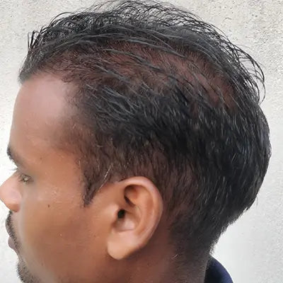 Before - Sachin Nagpal