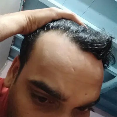 Before - Amit Chauhan