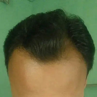 After - Nitin Malhotra