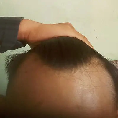 Before - Nitin Malhotra