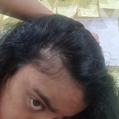 Before - Pallavi Sharma