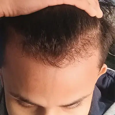 Before - Rohit Yadav